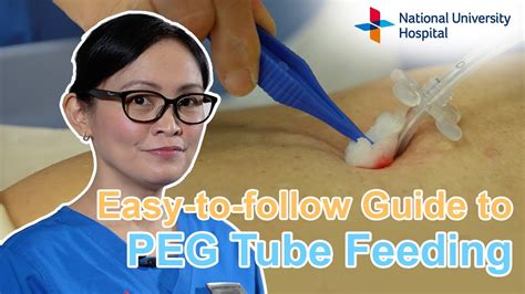 Easy To Follow Guide To Peg Tube Feeding Youtube