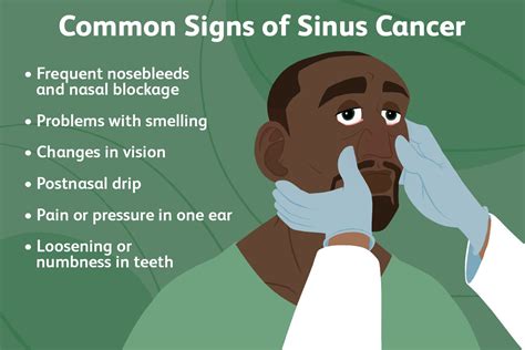 Sinus Cancer Signs Symptoms And Complications
