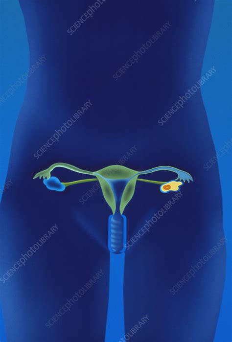 Female Reproductive System Stock Image P6160305 Science Photo