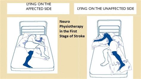Physio For Life Positioning For Stroke Patients