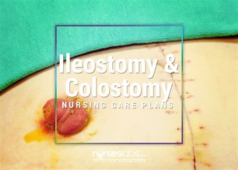 10 Ileostomy And Colostomy Fecal Diversions Nursing Care Plans