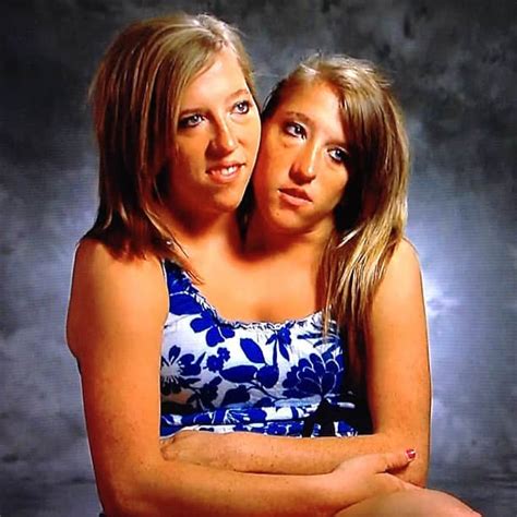 Top Are Abby And Brittany Hensel Still Conjoined Twins