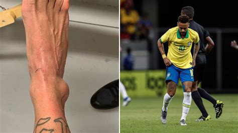 Neymar Jr Injury