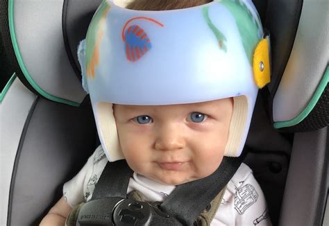 Baby Flat Head Helmet Price Lorina Irish