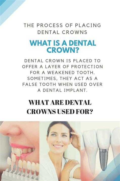 Holistic Dental Crowns Before And After Watches Dentistas