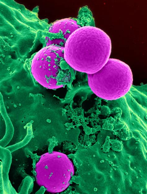 White Blood Cells Under An Electron Microscope Free Photo Image Finder
