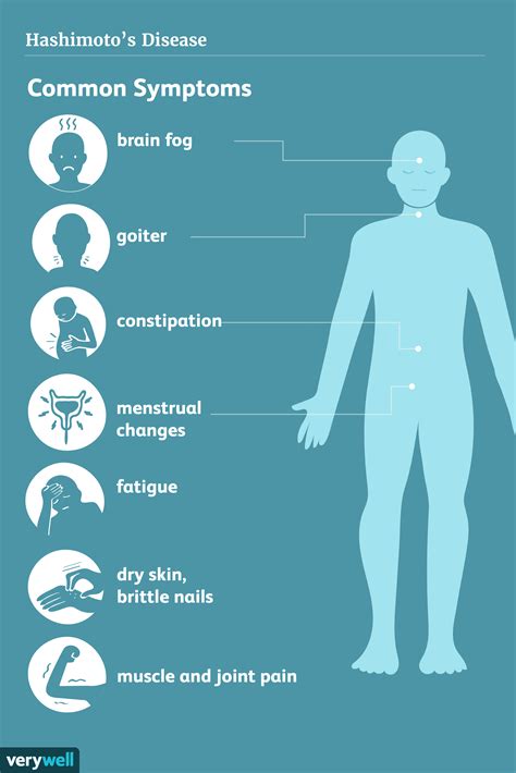 Hashimotos Disease Signs Symptoms And Complications