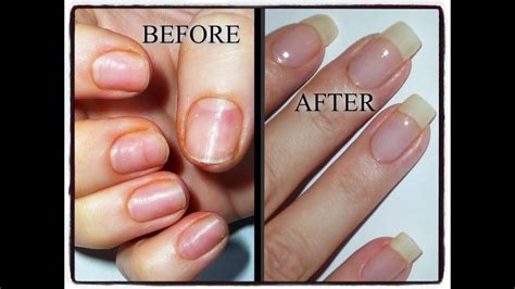 My Nail Journey Growing Natural Nails After Damage From Acrylicsgels