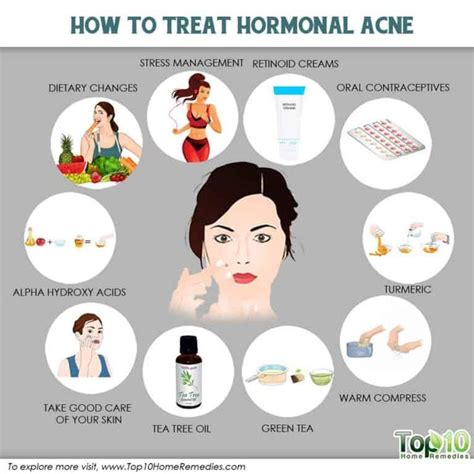 How To Treat Hormonal Acne Acne Hormonal Treat Hormonal Acne Acne Remedies Natural Acne