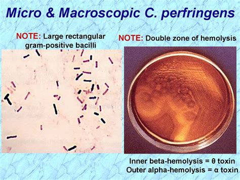 Anaerobic Gram Positive Spore Forming Bacilli Online Presentation