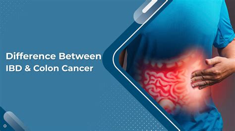 Difference Between Inflammatory Bowel Disease And Colon Cancer