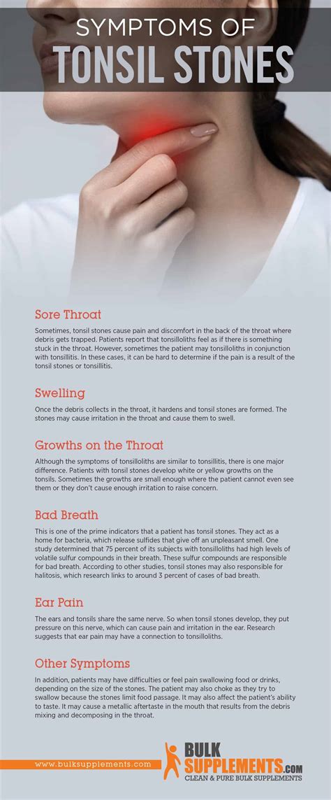 Tablo Read Tonsilloliths Tonsil Stones Risk Factors Symptoms