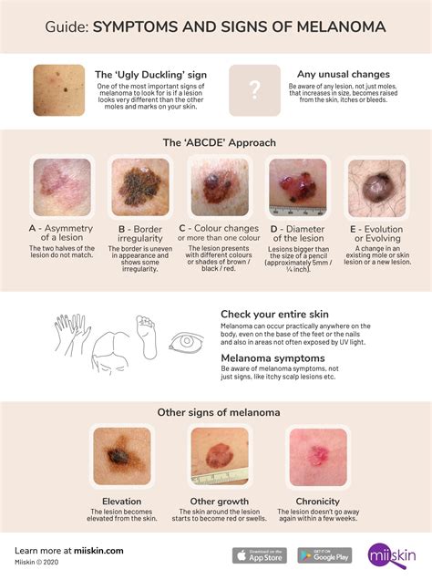 What Does The Early Stage Of Melanoma Look Like Skin Cancer Photos