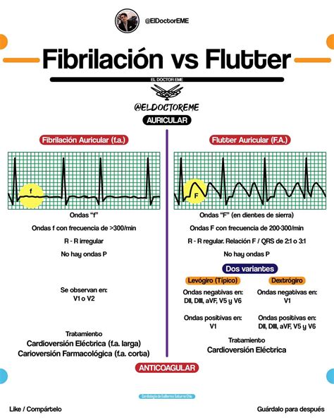 Zona De Salud De Ofra FibrilaciÓn Vs Flutter Auricular