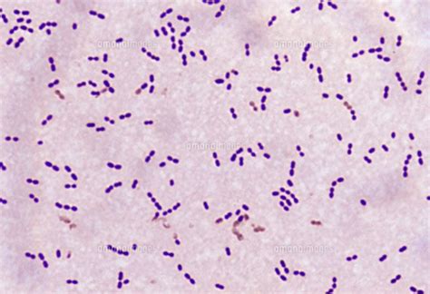 Streptococcus Pneumoniae Cocci In Pairs Gram Streptococcus