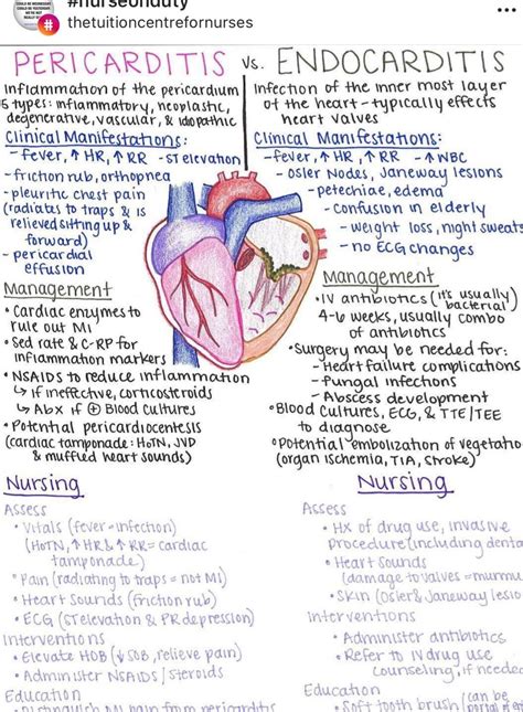 Cardiovascular Care Nursing Mnemonics And Tips Artofit