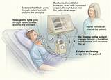 Where Can Respiratory Therapist Work Images