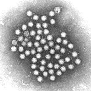 The first outbreak was described in norwalk, ohio, in 1968  1,2 . Norovirus identificados en las muestras de agua que ...