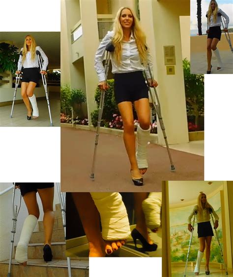 Castlinda Casts Braces Sprain Crutches Cnews