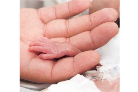 She has now broken the record set by halima cisse of mali, who gave birth to nine babies at a however, all were born alive and will spend the next few months in incubators before she and her. As many as 1 in 7 babies born in South Africa is premature ...