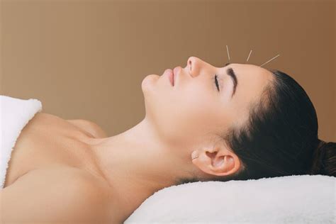 L'acupuncture pour maigrir : une solution douce et efficace