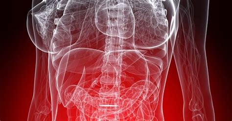 Bladder cancer is a cancer that starts in the bladder. Brady Urology at Johns Hopkins Hospital: Non-Urothelial ...