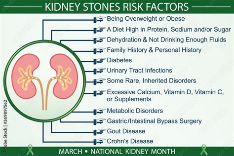 Kidney Stones Risk Factors Infographic Vector March National Kidney