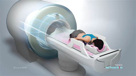 Breast MRI Video Medical Video Library