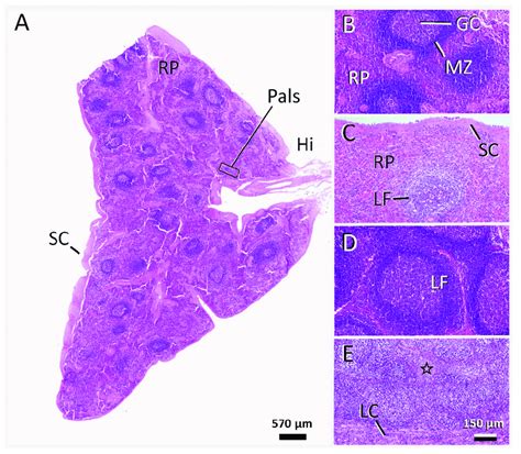 Lymphatic Tissue Changes In The Cat Abd Compared To A Cat With