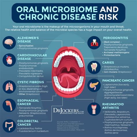 Holistic Dental Care And The Oral Microbiome