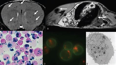 Cellular Imaging With Mri Topics In Magnetic Resonance Imaging
