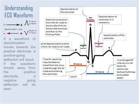 Ekg Labeled Diagram General Wiring Diagram