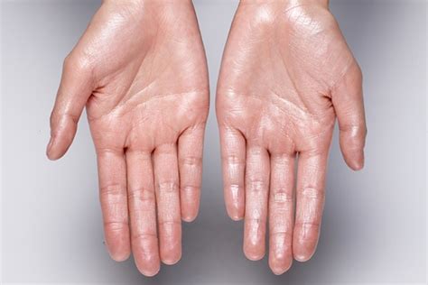 How To Soothe Super Dry Hands Be Beautiful India