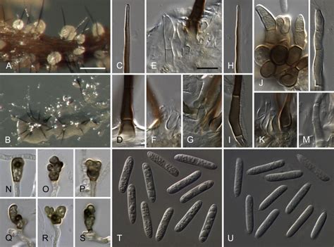 Colletotrichum Tabacum From Ex Neotype Strain N150 Ab Conidiomata