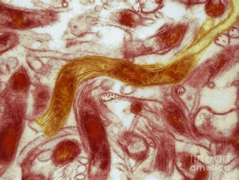 Of those with morgellons disease, 77%. Borrelia Burgdorferi Lyme Disease, Tem Photograph by David ...