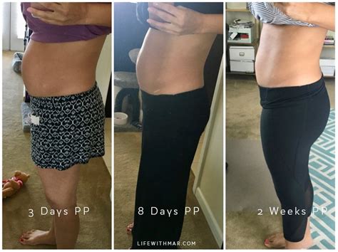 an honest bellefit postpartum girdle review with before and afters
