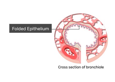 Learn about 32 anatomy getbodysmart with free interactive flashcards. Bronchiole Wall Anatomy