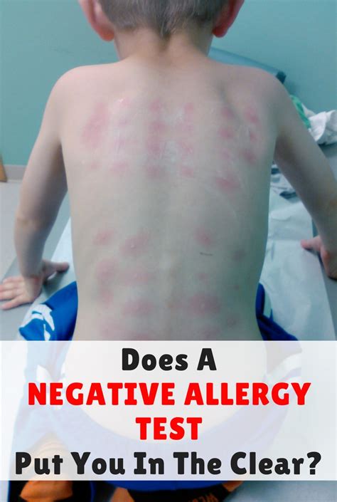 Does A Negative Allergy Test Put You In The Clear Simple Steps To Move