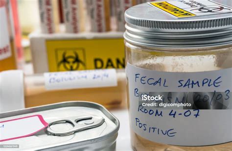 Fecal Sample Of A Person Infected With Botulism Infection In Tin Cans