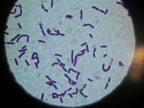Lebensmittelvertung Durch Bacillus Cereus Bakterien Medde