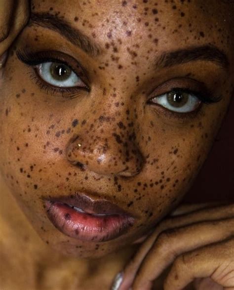 99 Tumblr Freckles On Dark Skin Beautiful Freckles Women With
