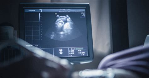 When And Why To Get Ultrasounds During Pregnancy 2023