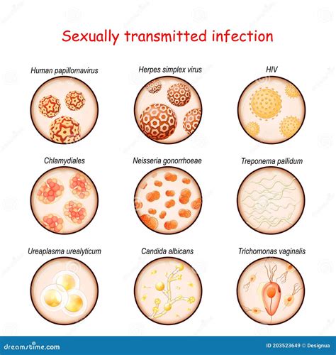 CAUSATIVE AGENTS OF ACUTE INTESTINAL INFECTIONS Vector Illustration