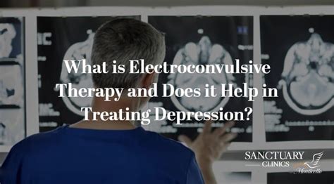 What Is Electroconvulsive Therapy And Does It Help In Treating Depression Sanctuary Clinics
