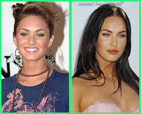 plastic surgery before and after megan fox before and after
