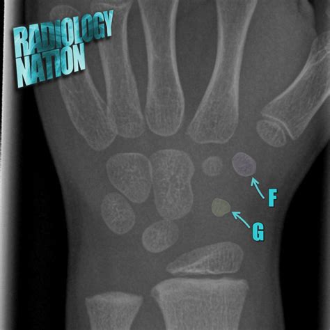 Musculoskeletal Radiographs — Radiology Nation