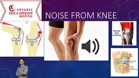 Cause Of Noise From Knee Youtube