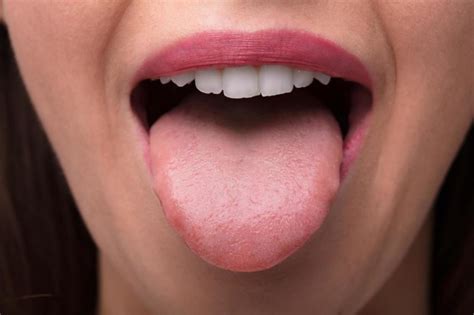 Sore Tongue 13 Possible Causes And Treatment