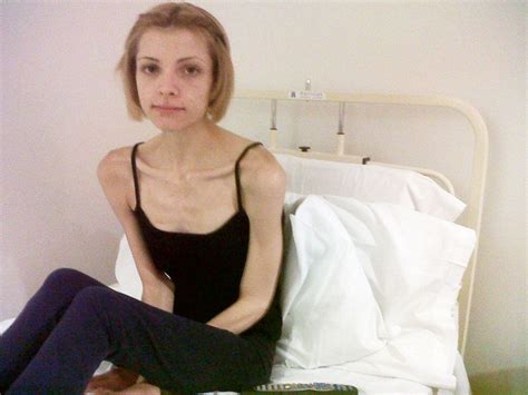 Sian Clarke Who Has Recovered From Anorexia Coventry Telegraph