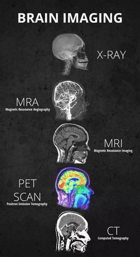 Different Brain Scan Methods 9gag Dailyhealthylivingtips Medical